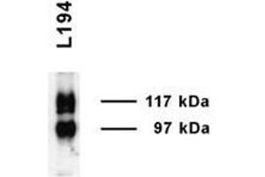 UT A1 Immunoblot (Rat inner medulla). (Solute Carrier Family 14 (Urea Transporter, Kidney) Member 2 (SLC14A2) (AA 911-929) Antikörper)