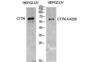 Western Blot (WB) analysis of HepG2-UV cells using Acetyl-Cortactin (K235) Polyclonal Antibody. (Cortactin Antikörper  (acLys235))