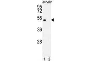 Western Blotting (WB) image for anti-E2F Transcription Factor 1 (E2F1) (AA 342-371) antibody (ABIN3030786)