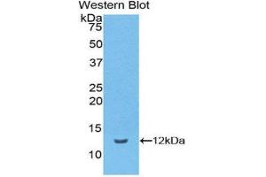 Western Blotting (WB) image for anti-Vitronectin (VTN) (AA 19-111) antibody (ABIN1174143) (Vitronectin Antikörper  (AA 19-111))