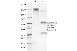 SDS-PAGE Analysis Purified Collagen VII Mouse Monoclonal Antibody (LH7. (COL7A1 Antikörper)