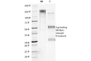 SDS-PAGE (SDS) image for anti-Collagen, Type VII, alpha 1 (COL7A1) antibody (ABIN6939168)
