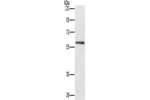 Gel: 8 % SDS-PAGE, Lysate: 40 μg, Lane: Mouse spleen tissue, Primary antibody: ABIN7131459(TRAFD1 Antibody) at dilution 1/400, Secondary antibody: Goat anti rabbit IgG at 1/8000 dilution, Exposure time: 4 minutes (TRAFD1 Antikörper)