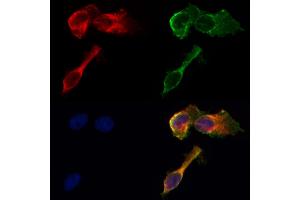 ABIN6260962 and ABIN6268678 staining HepG2 by IF/ICC.