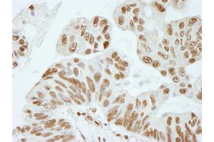 anti-5'-3' Exoribonuclease 2 (XRN2) (AA 900-950) antibody