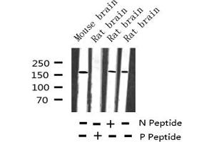 Western blot analysis of Phospho-IRS-1 (Ser636) expression in various lysates
