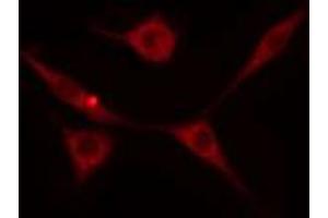 ABIN6274237 staining HeLa cells by IF/ICC. (GRK5 Antikörper  (Internal Region))