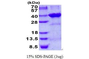 Image no. 1 for Syndecan Binding Protein (Syntenin) 2 (SDCBP2) protein (His tag) (ABIN1098465)