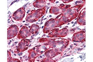 Anti-THRA antibody IHC of human breast.