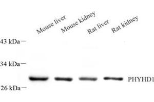 Western blot analysis of PHYHD1 (ABIN7075081) at dilution of 1: 500