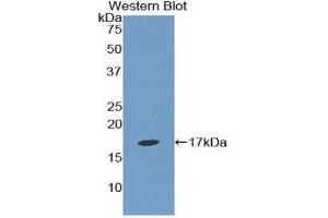 Western Blotting (WB) image for anti-Epsin 1 (EPN1) (AA 279-437) antibody (ABIN1858728) (Epsin 1 Antikörper  (AA 279-437))