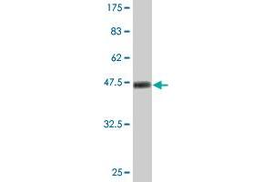 Western Blot detection against Immunogen (47. (Ube2t Antikörper  (AA 1-197))