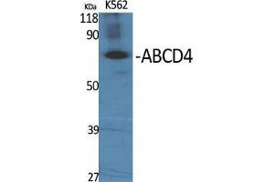Western Blotting (WB) image for anti-ATP-Binding Cassette, Sub-Family D (Ald), Member 4 (ABCD4) (Internal Region) antibody (ABIN3183118)