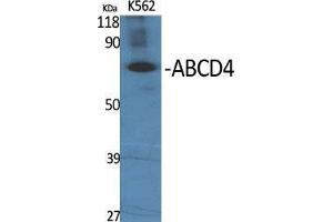 Western Blot (WB) analysis of specific cells using ABCD4 Polyclonal Antibody.
