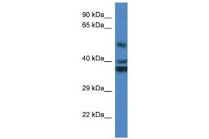 Western Blot showing RTN4IP1 antibody used at a concentration of 1 ug/ml against Fetal Kidney Lysate (RTN4IP1 Antikörper  (Middle Region))