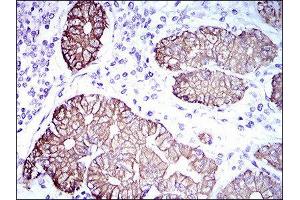 Immunohistochemistry (IHC) image for anti-Keratin 5 (KRT5) (AA 316-590) antibody (ABIN1845567) (Cytokeratin 5 Antikörper  (AA 316-590))