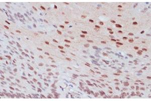 Immunohistochemistry of paraffin-embedded Human esophageal using Phospho-CREB1(S133) Polyclonal Antibody at dilution of 1:100 (40x lens). (CREB1 Antikörper  (pSer133))