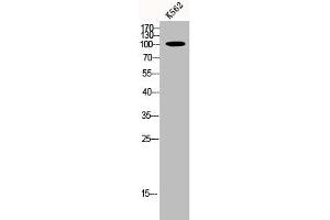 Western Blot analysis of K562 cells using p115 Polyclonal Antibody (USO1 Antikörper  (C-Term))