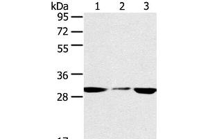 Western Blot analysis of PC3 and hepg2 cell, Human fetal liver tissue using SDHB Polyclonal Antibody at dilution of 1:400 (SDHB Antikörper)