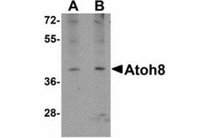 Image no. 1 for anti-Atonal Homolog 8 (ATOH8) (C-Term) antibody (ABIN478063) (ATOH8 Antikörper  (C-Term))