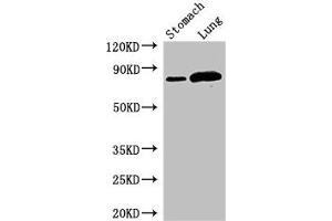 Western Blot Positive WB detected in: Mouse stomach tissue, Rat lung tissue All lanes: SLC3A1 antibody at 2.