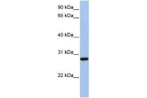 WB Suggested Anti-VDAC3 Antibody Titration: 0. (VDAC3 Antikörper  (N-Term))