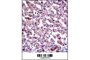 GDI2 Antibody immunohistochemistry analysis in formalin fixed and paraffin embedded human liver tissue followed by peroxidase conjugation of the secondary antibody and DAB staining. (GDI2 Antikörper  (AA 135-164))