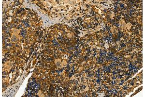 ABIN6258949 and ABIN6273453 at 1/100 staining Rat spleen tissue by IHC-P.