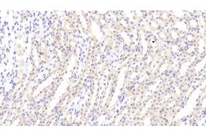 Detection of AXL in Rat Kidney Tissue using Polyclonal Antibody to AXL Receptor Tyrosine Kinase (AXL) (AXL Antikörper  (AA 21-202))