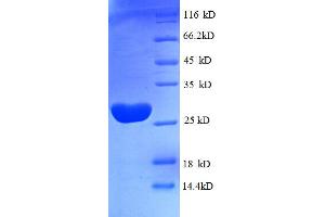 SDS-PAGE (SDS) image for Tu Translation Elongation Factor, Mitochondrial (Tufm) (AA 46-290), (partial) protein (His tag) (ABIN4976536) (TUFM Protein (AA 46-290, partial) (His tag))