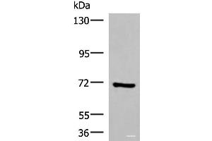 Western blot analysis of HepG2 cell lysate using PAPSS2 Polyclonal Antibody at dilution of 1:1000 (PAPSS2 Antikörper)