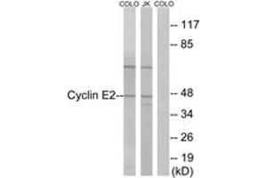 Western blot analysis of extracts from COLO/Jurkat cells, using Cyclin E2 (Ab-392) Antibody.
