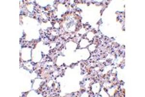 Immunohistochemistry of TRPC6 in mouse lung tissue with TRPC6 polyclonal antibody  at 10 ug/mL . (TRPC6 Antikörper  (N-Term))