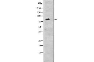 Western blot analysis of CDH6 expression in 293 cell line lysates ,The lane on the left is treated with the antigen-specific peptide. (CDH6 Antikörper  (C-Term))