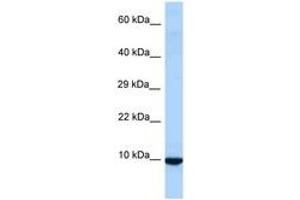 Image no. 1 for anti-Inhibitor of DNA Binding 3, Dominant Negative Helix-Loop-Helix Protein (ID3) (AA 58-107) antibody (ABIN6748024)