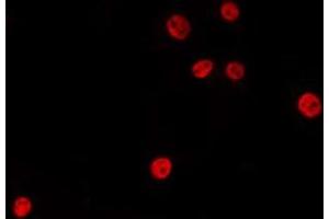ABIN6275444 staining LOVO by IF/ICC. (RANBP6 Antikörper  (Internal Region))