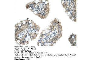 Human Intestine (NAB1 Antikörper  (N-Term))