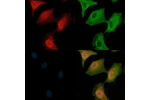 MKK3/MKK6 Antibody staining A549 cells(H2O2 treatment) by IF/ICC. (MAP2K3 Antikörper)