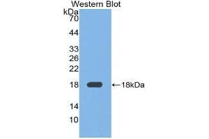 Western blot analysis of the recombinant protein. (Fibronectin Antikörper  (AA 2117-2236))