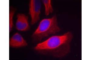 Immunofluorescence staining of methanol-fixed HeLa cells using IKK-β (Phospho-Tyr199) Antibody (E011305, Red) (IKBKB Antikörper  (pTyr199))