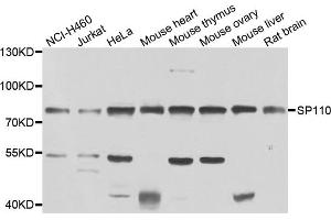 Western blot analysis of extracts of various cell lines, using SP110 antibody (ABIN4905277) at 1:1000 dilution. (SP110 Antikörper)