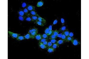 IF analysis of CLDN16/Claudin-16 using anti-CLDN16/Claudin-16 antibody (ABIN7602819). (Claudin 16 Antikörper  (C-Term))