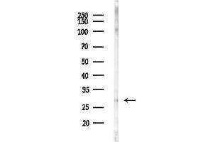 anti-Family with Sequence Similarity 58, Member A (FAM58A) (Internal Region) antibody