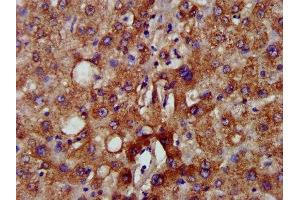 IHC image of ABIN7160839 diluted at 1:500 and staining in paraffin-embedded human liver tissue performed on a Leica BondTM system. (NADK2 Antikörper  (AA 16-156))