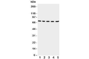 Western blot testing of NRG1 antibody and Lane 1: rat spleen;  2: (r) kidney;  3: (r) brain;  4: human HeLa;  5: (h) SMMC-7721 cell lysate (Neuregulin 1 Antikörper  (C-Term))