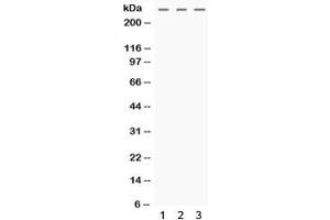Western blot testing of human 1) HeLa, 2) MCF7 and 3) SW620 cell lysate with MGA antibody. (MGA Antikörper)