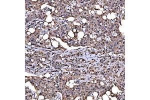 IHC analysis of SNRPD2 using anti-SNRPD2 antibody (ABIN7598963).