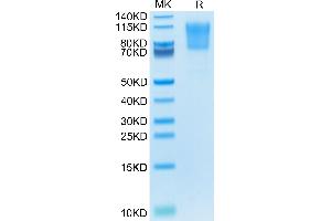 SDS-PAGE (SDS) image for Selectin P Ligand (SELPLG) (AA 42-320) protein (His tag) (ABIN7275486)