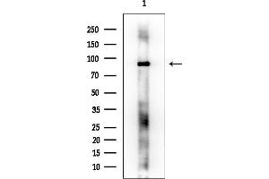 Western blot analysis of lysates from EC304 cells, using PTK7 Mouse Monoclonal Antibody at 1/1000 dilution.