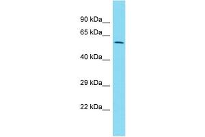 Host:  Rabbit  Target Name:  ZNF671  Sample Type:  Uterus Tumor lysates  Antibody Dilution:  1. (ZNF671 Antikörper  (C-Term))